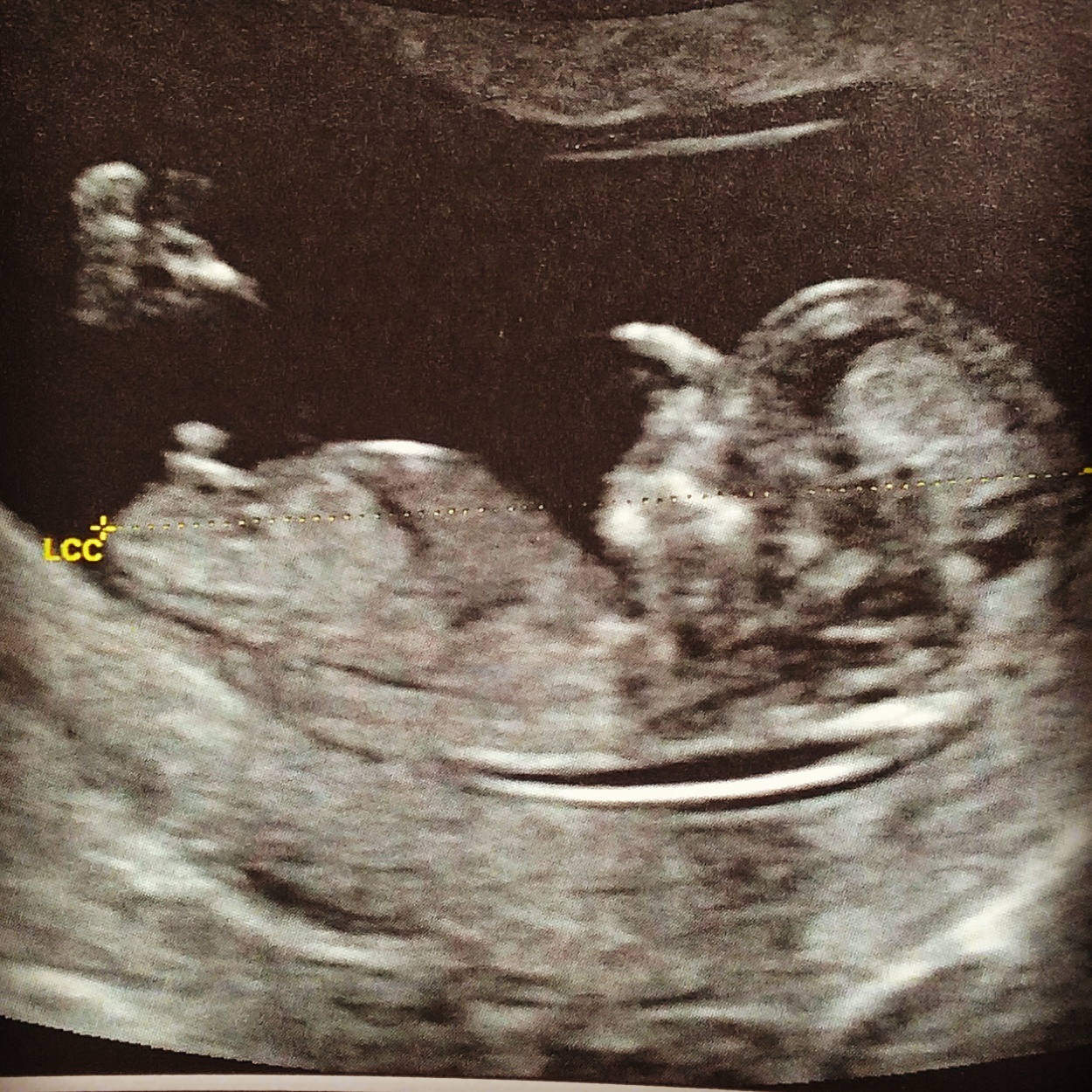 IMG_20150618_124642.jpg image